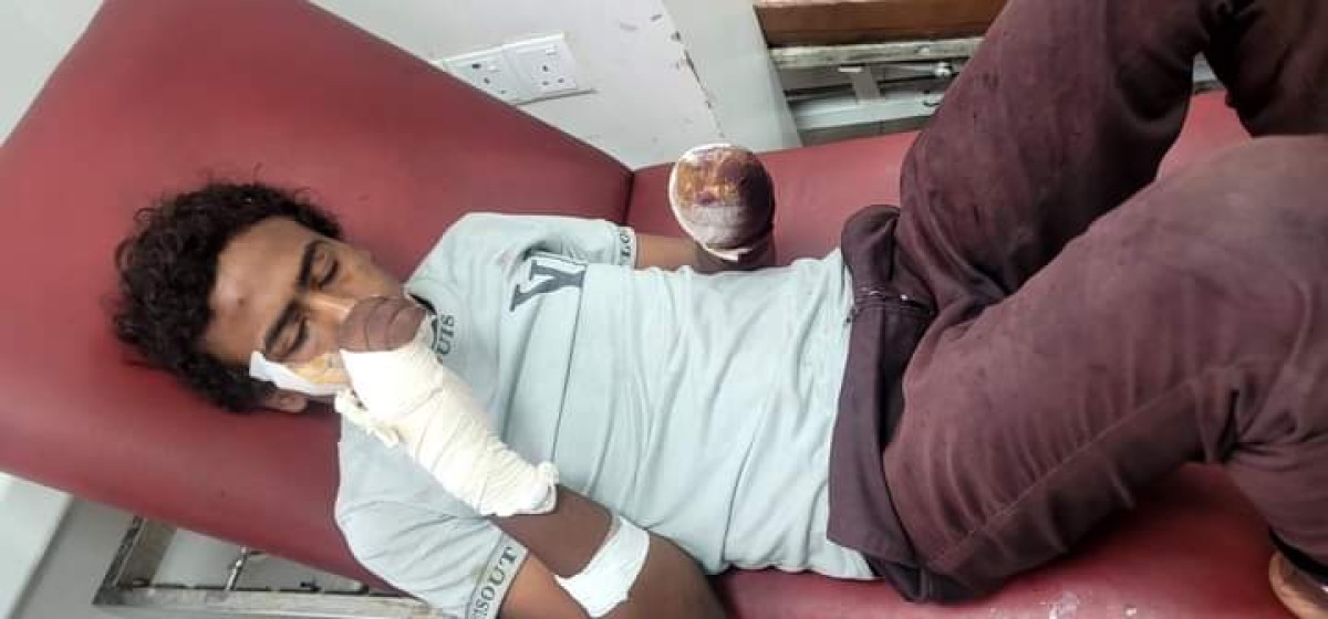 تعز: إصابة طفل بانفجار لغم حوثي في مديرية مقبنة