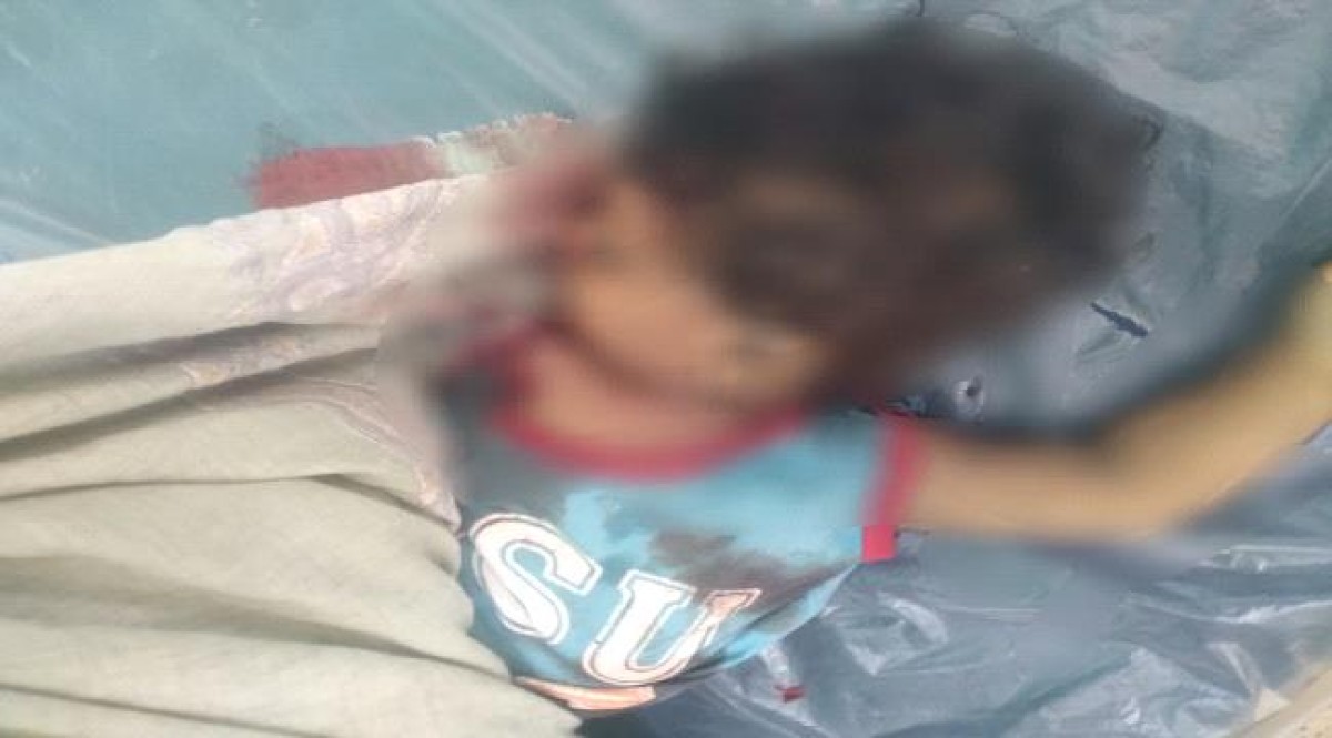 مقتل طفل بقصف حوثي على قرى حيفان في تعز