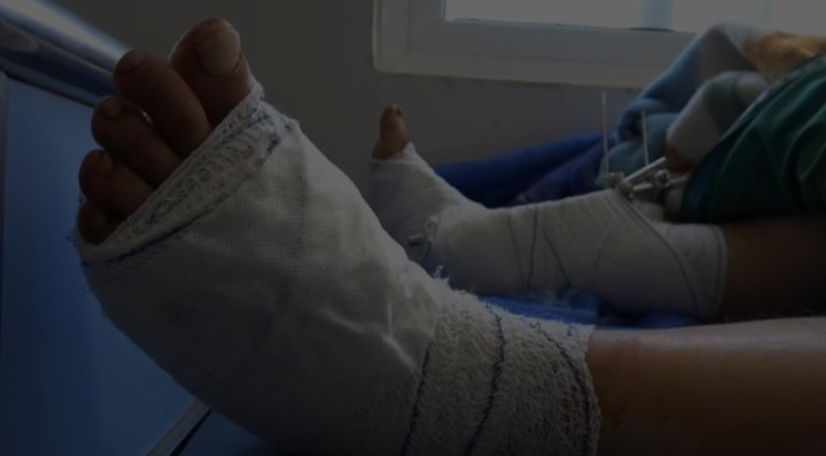 تعز : إصابة مواطن برصاصة قناصة الحوثيين شرقي المدينة