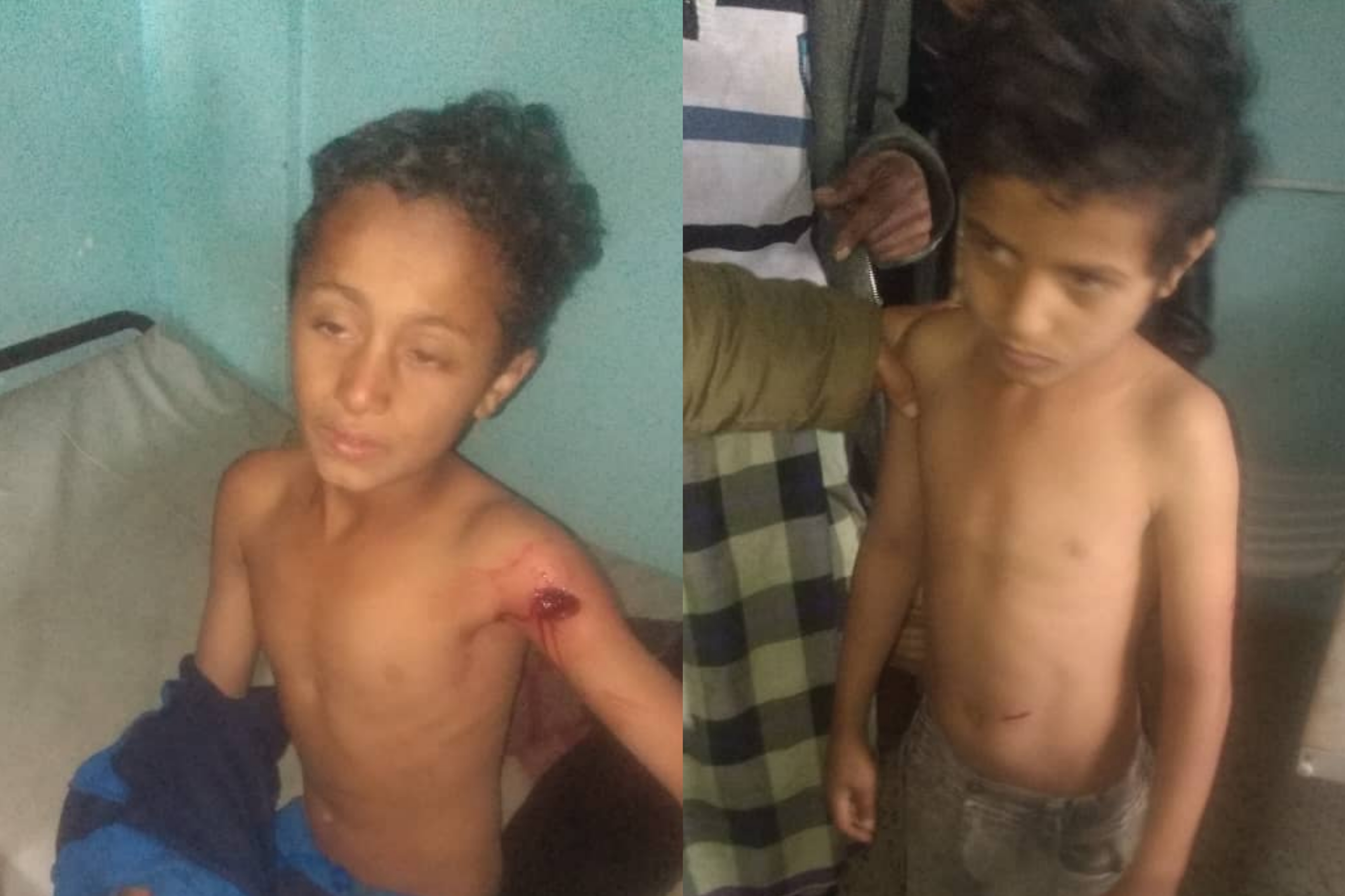 تعز.. إصابة طفلين برصاص قناصة مليشيا الحوثي شرق المدينة