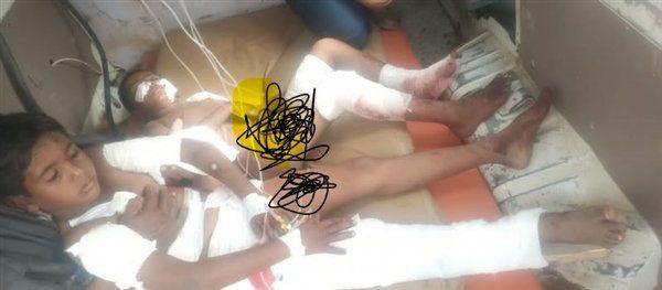 حجة: إصابة طفلين بانفجار لغم زرعته ميليلشيا الحوثي
