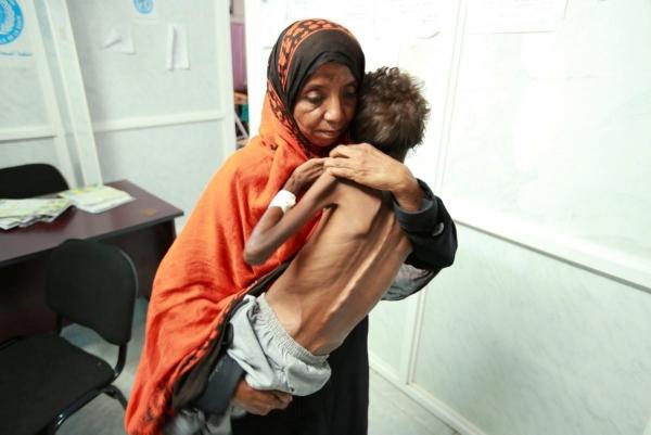 الأمم المتحدة: 6 ملايين طفل باليمن على بعد خطوة من المجاعة