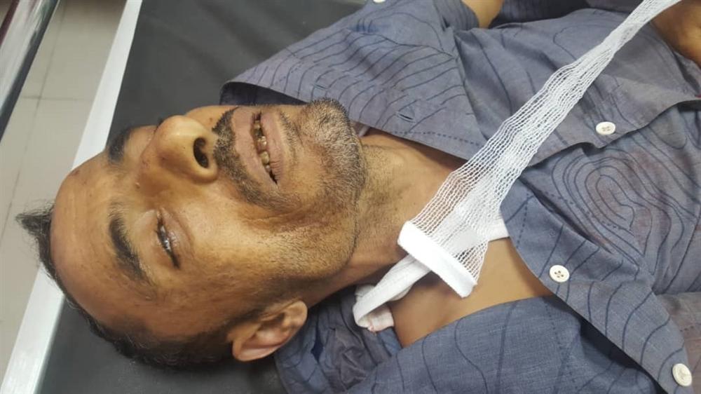تعز: وفاة مدني متأثرًا بإصابته برصاص قناص حوثي في منطقة الشقب
