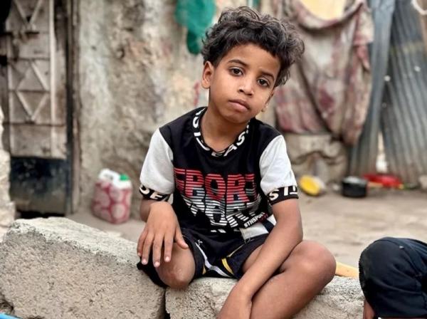 تقرير: معاناة الأطفال الذين أصيبوا ويتضورون جوعا في حرب اليمن المنسية