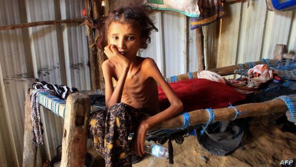 شبكة دولية تحذر: نصف سكان اليمن مهددون بالمجاعة العام القادم