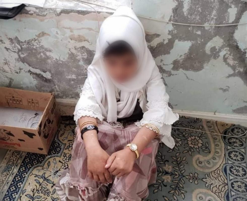 مركز حقوقي يدعو للتحرك لإنصاف طفلة يمنية تعرضت للضرب المبرح