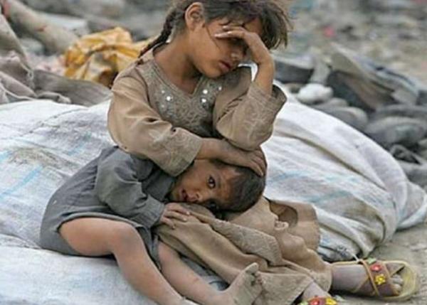 الأمم المتحدة: معدلات الجوع وسوء التغذية أكثر انتشارًا في مناطق سيطرة الحوثيين
