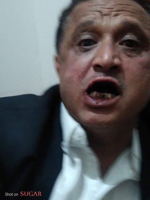 مسلحون حوثيون يعتدون بالضرب على صحفي أمام منزله بصنعاء