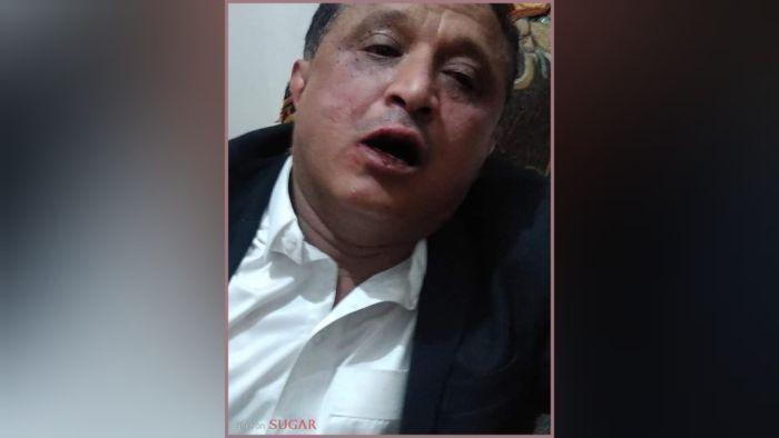 الاتحاد الدولي للصحفيين يدين اعتداء جماعة الحوثي على صحفي بصنعاء