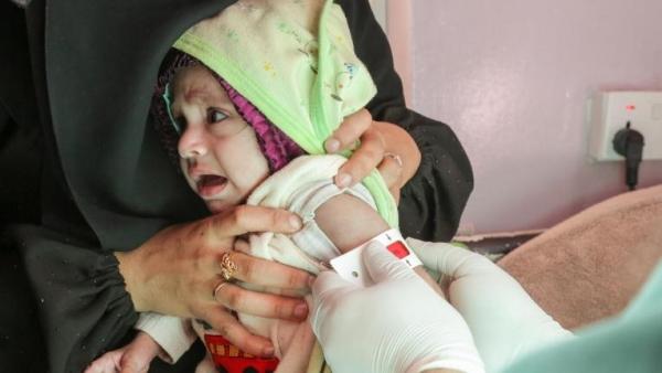 الأمم المتحدة تحذر من ارتفاع حالات سوء التغذية الحاد في اليمن