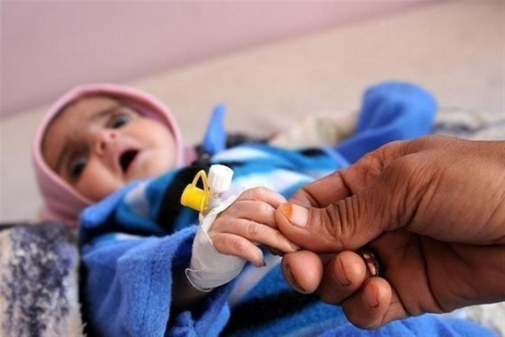 البنك الدولي: 150 مليون دولار لدعم الصحة والغذاء في اليمن