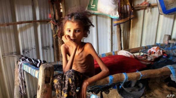 توقعات بانزلاق مليون شخص إضافي في اليمن إلى هوة المجاعة منتصف 2024