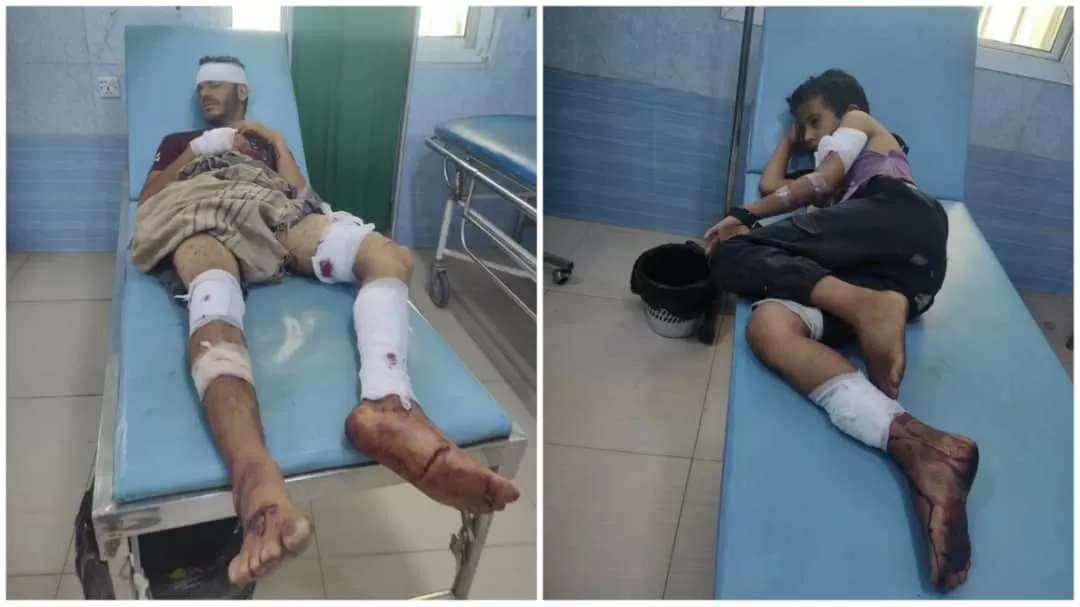 إصابة شقيقان أحدهما طفل في انفجار عبوة ناسفة من مخلفات الحوثيين شرق تعز