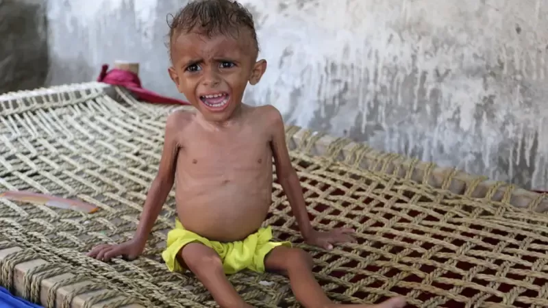 تقرير : اليمن بين أفقر عشر دول في العالم لعام 2025 بسبب الحرب والانهيار الاقتصادي