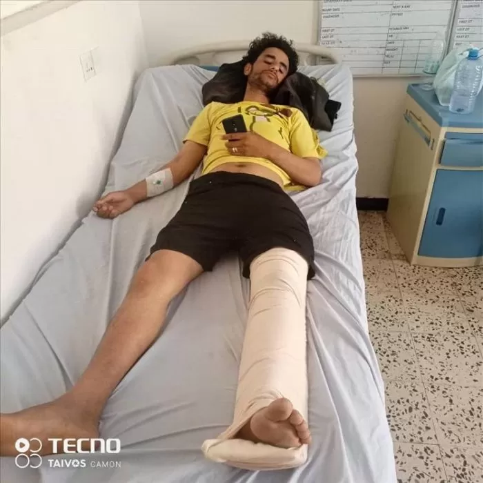 قناص حوثي يستهدف مدنيًا أثناء عمله بمزرعته شمال قعطبة في الضالع