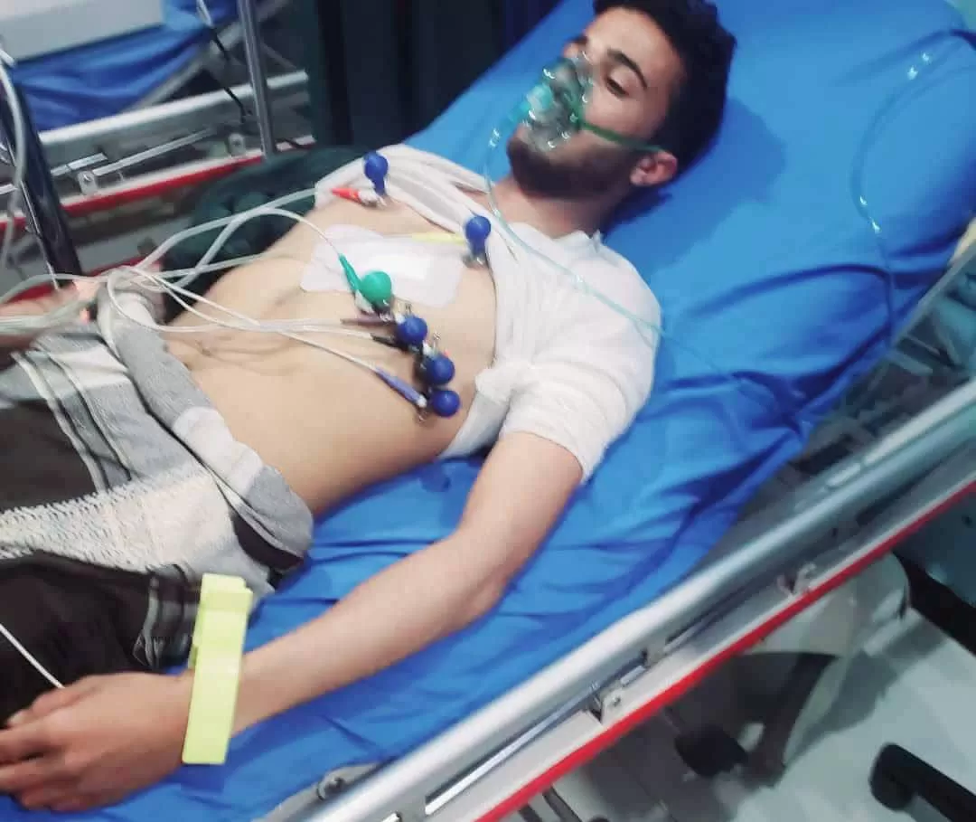 الحوثيون يحتجزون جريحاً بعد تعرضه لاعتداء مسلح في عمران